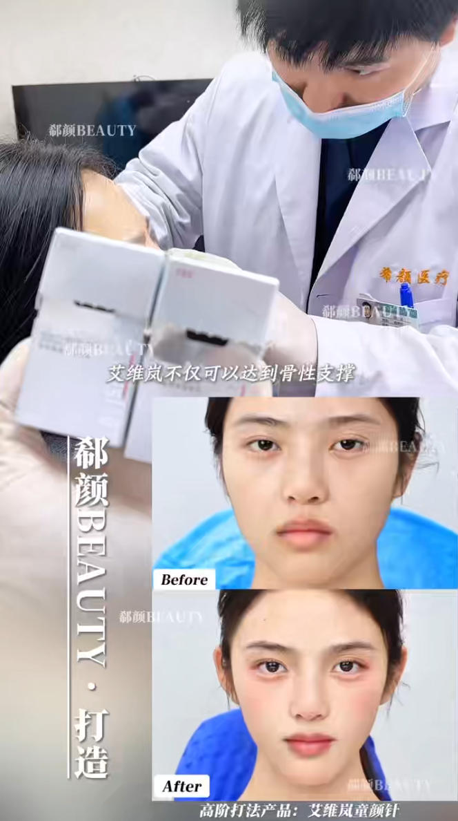 Shanghai-Aivilan-Jugend sieht sich mit der Anti-Aging-Weigerung der Maskenverweigerung Injection_Chen Staatsanwalt konfrontiert – Fallstudie